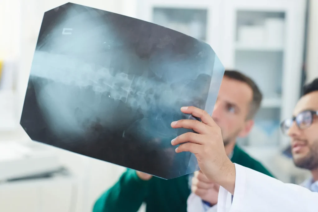 Doctors looking at x-ray