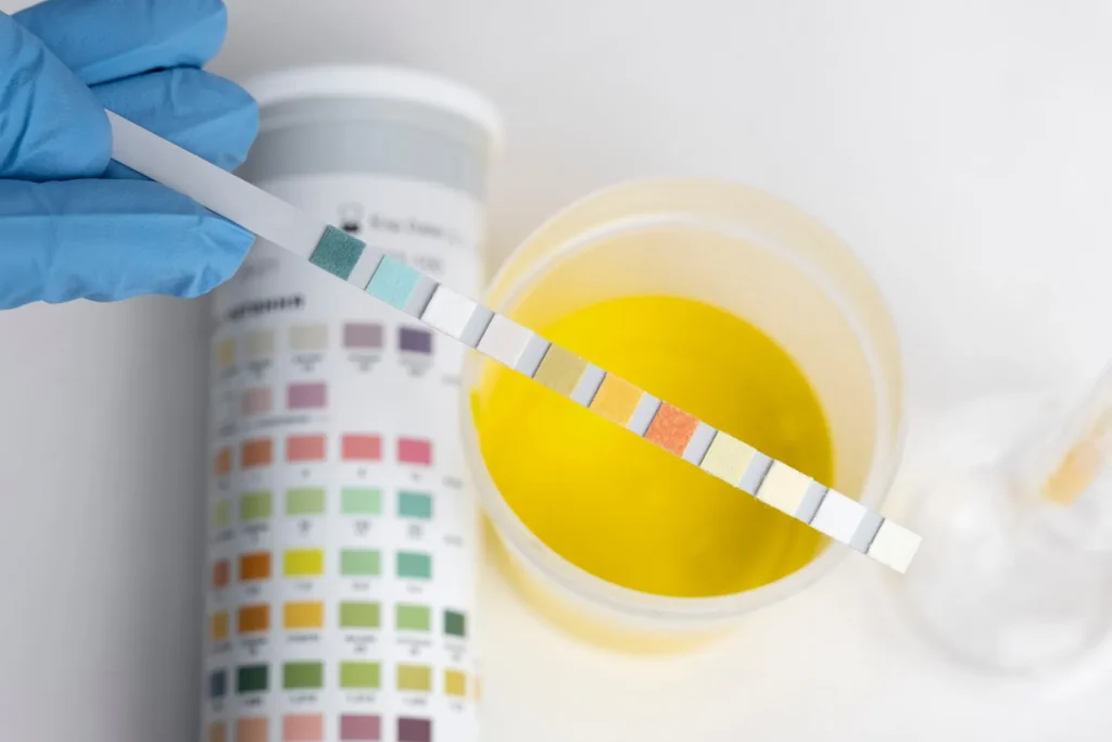 Urine Test